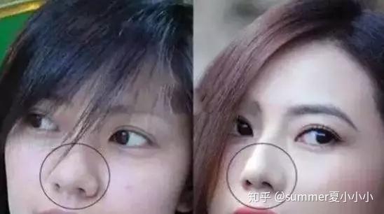 日本整容|跟着高圆圆学微调,从好看进化到惊艳真的很难吗? - 知乎