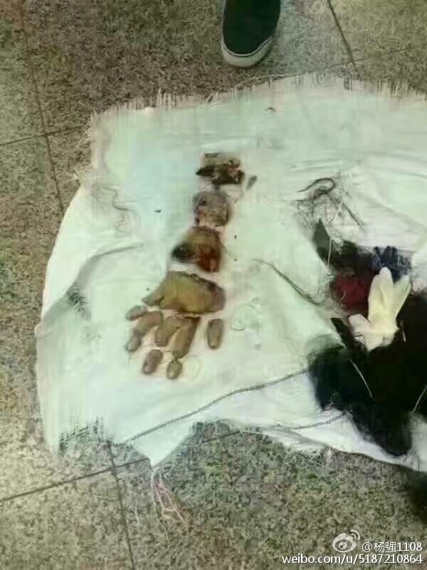 中国的临床医疗技术和美国差距有多大?