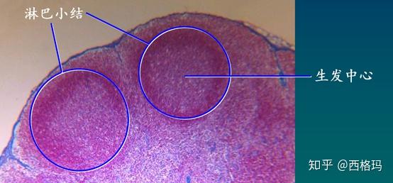 淋巴结生发中心图片