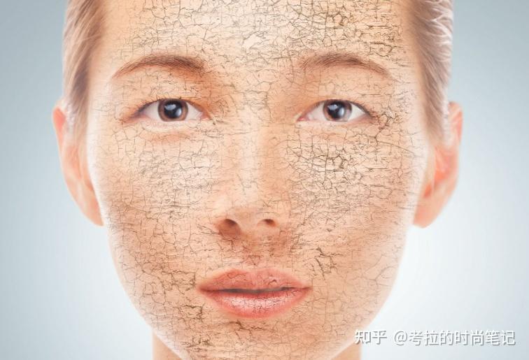 相信我皮肤干燥最重要的不是要补水而是要样做