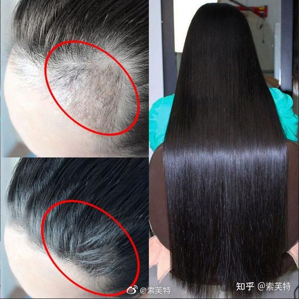 防脱洗发水推荐哪款洗发水防脱生发好防脱洗发水哪个牌最好