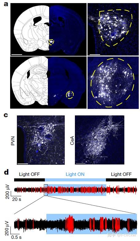 故事的大概是他们发现脾脏的神经是与脑部室旁核pvn和中央杏仁核cea有