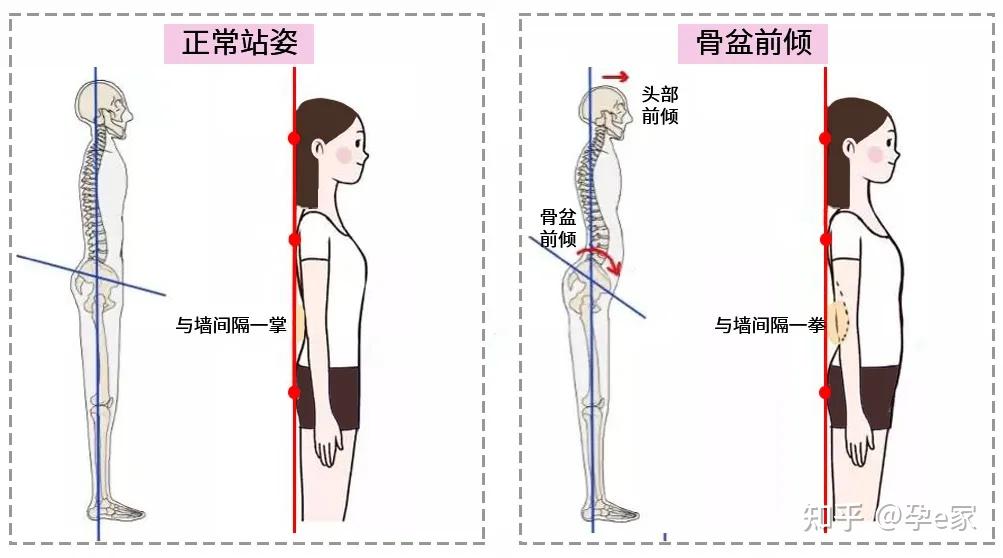 錯誤姿勢2:挺起肚子