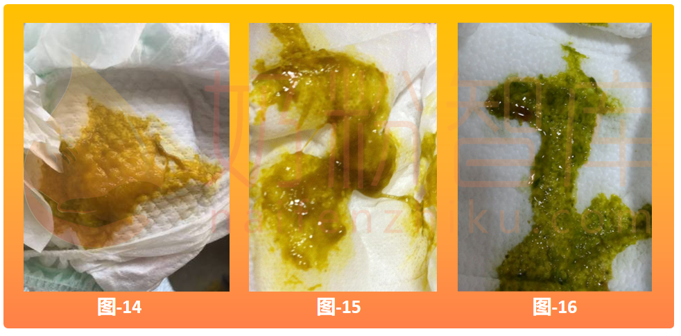 宝宝吃奶粉拉绿便、奶瓣、稀便、羊粪球...不一定要换奶粉!原因+对策来了! - 知乎