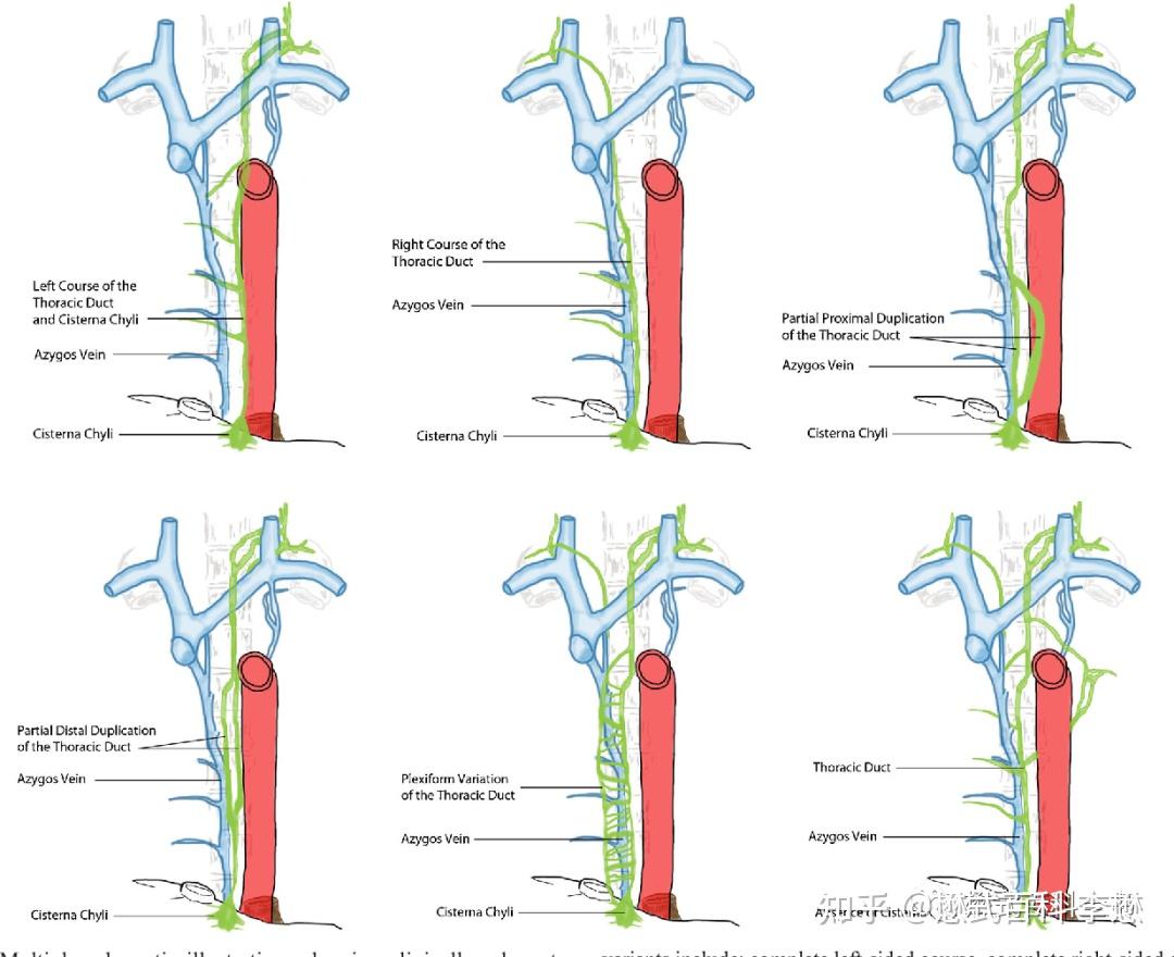 mri淋巴管造影成像