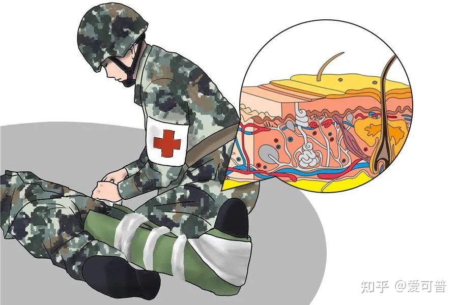 漫画科普|为什么老年人伤口愈合得比年轻人慢? - 知乎