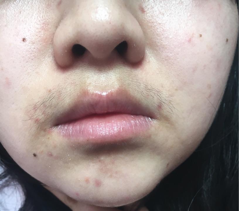 请对我的皮肤评价一下,提一些建议? - 七宝泰国