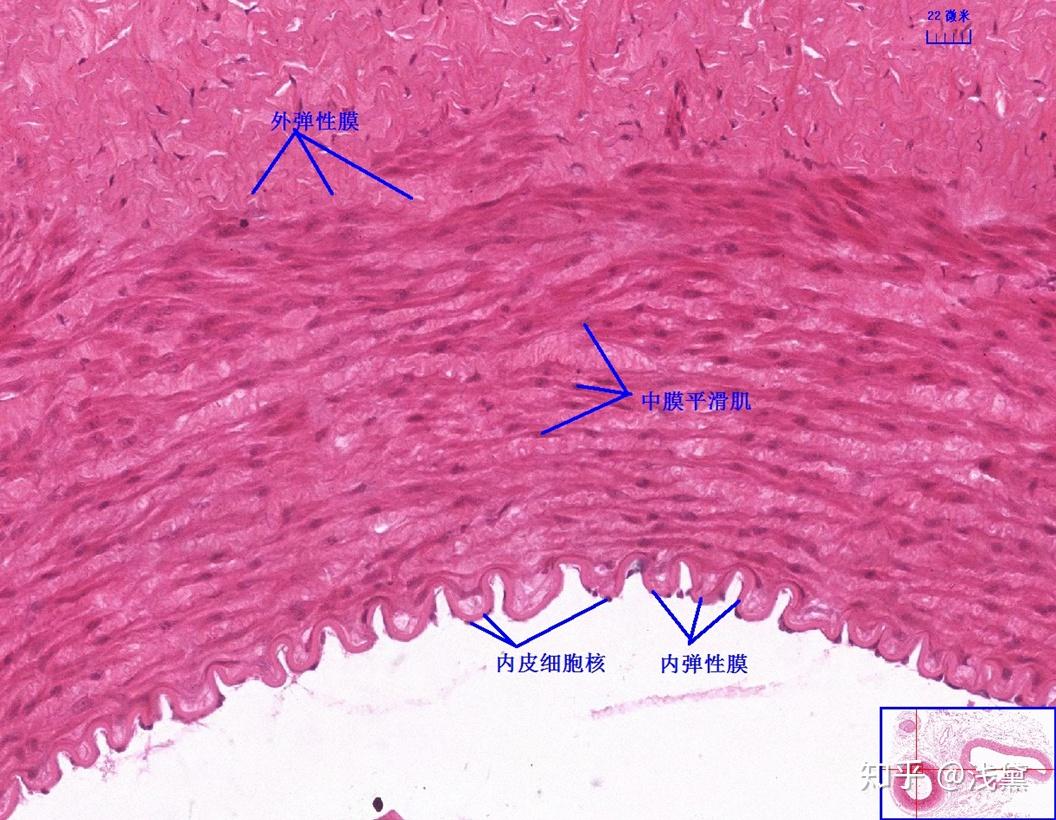 5.甲状腺(甲状腺滤泡,滤泡旁细胞)