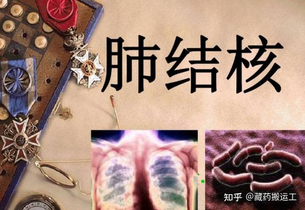 「肺结核」的治疗要趁早,来看看藏医有什么治疗指导! - 知乎