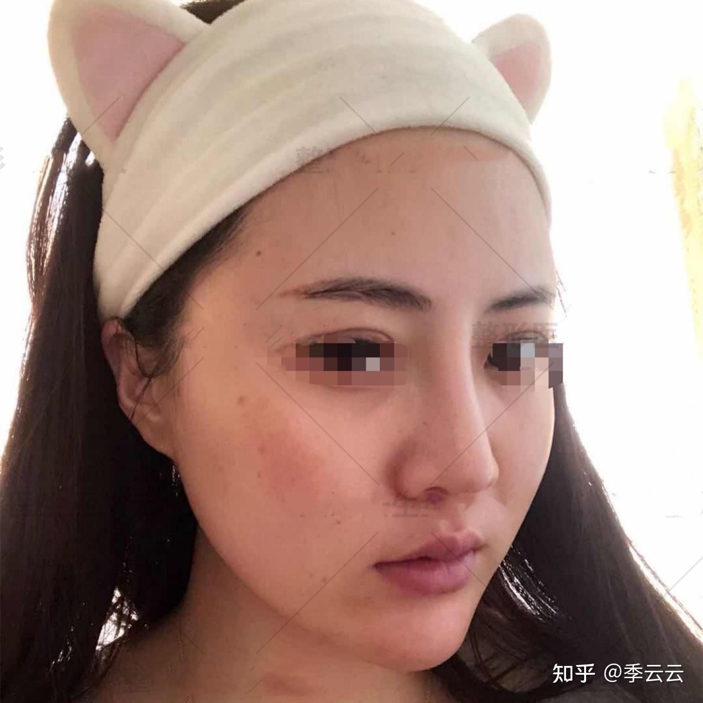 最好看的鼻子图片大全集 v2-7f02232190095bdc1b6b6a4a2efe45de_r.jpg