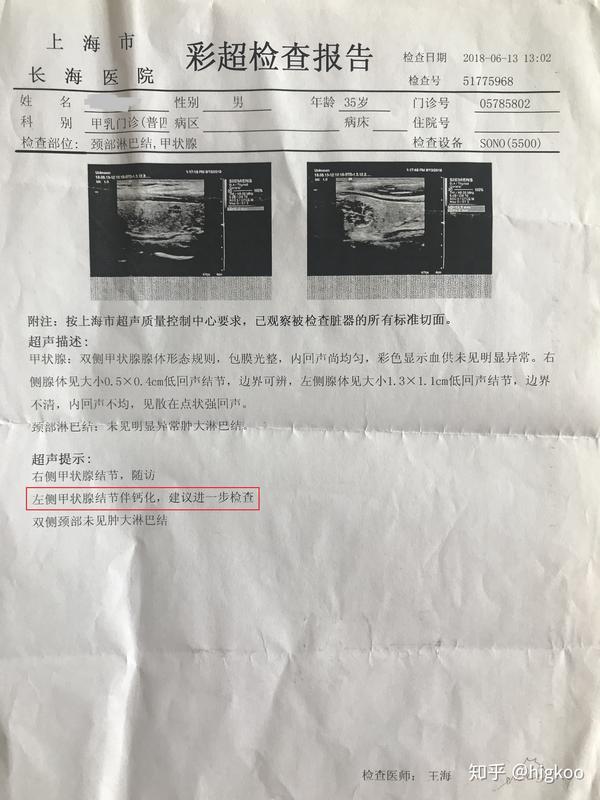 2018.6.13-上海长海医院-B超检查