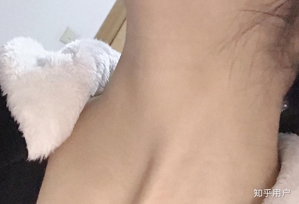 想问问各位女生你们都有喉结吗