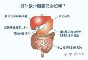 胆囊切除后有哪些危害 知乎