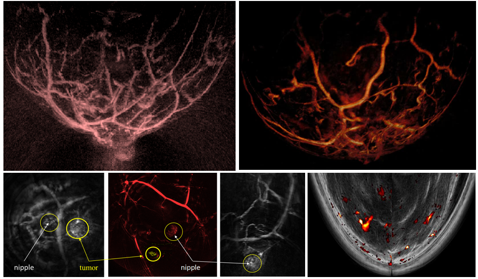 应用讲堂上篇光声成像在生物医学研究