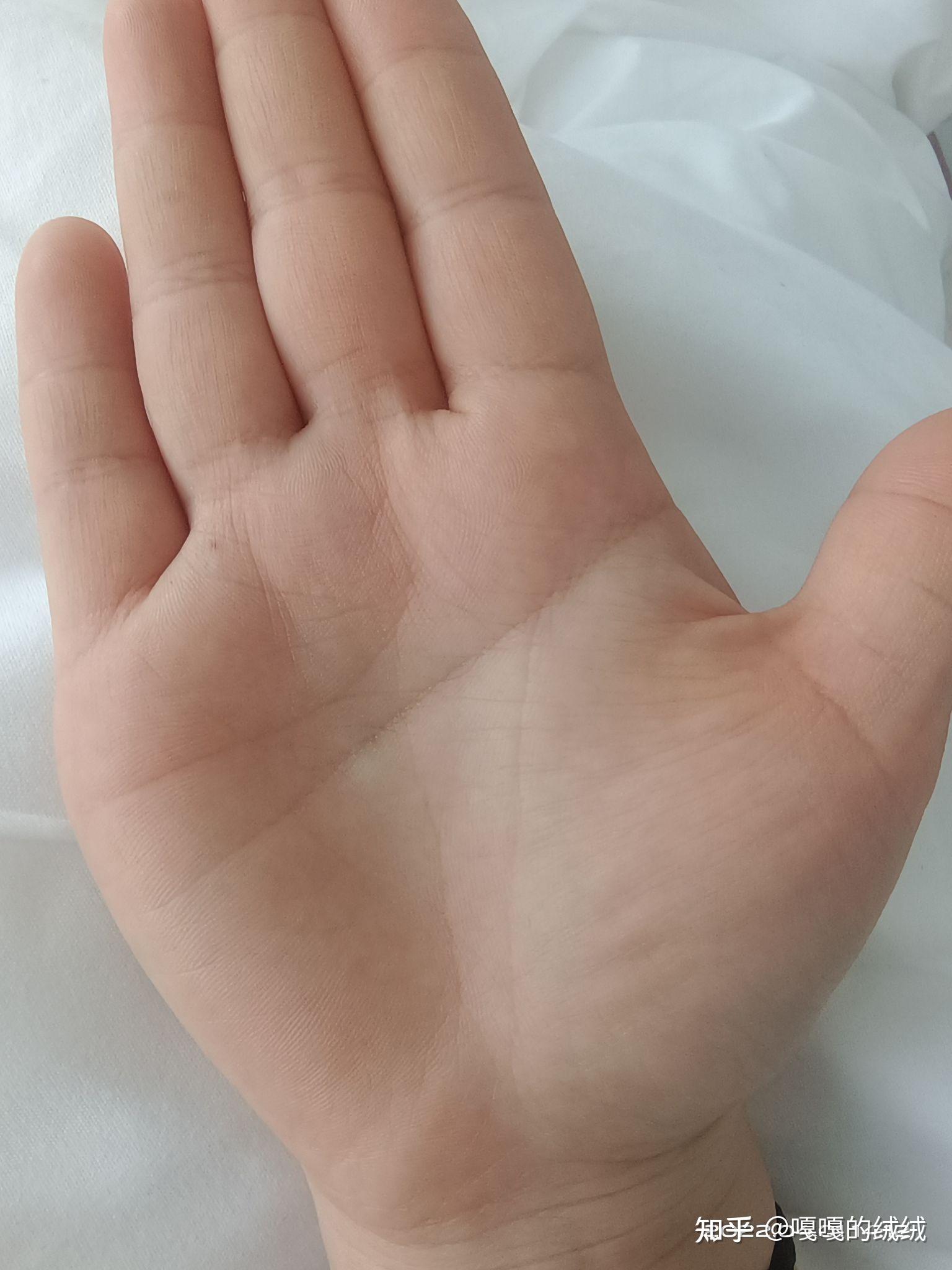 拜托帮我看看这是断掌还是悉尼线