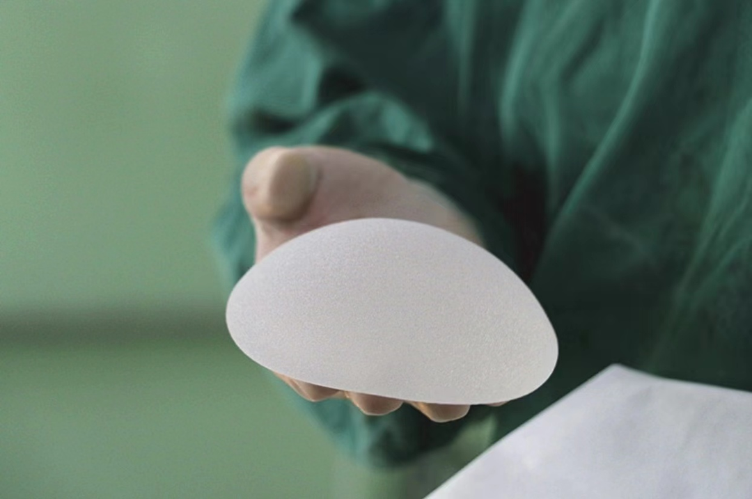 涨姿势,假体隆胸之后能哺乳吗?