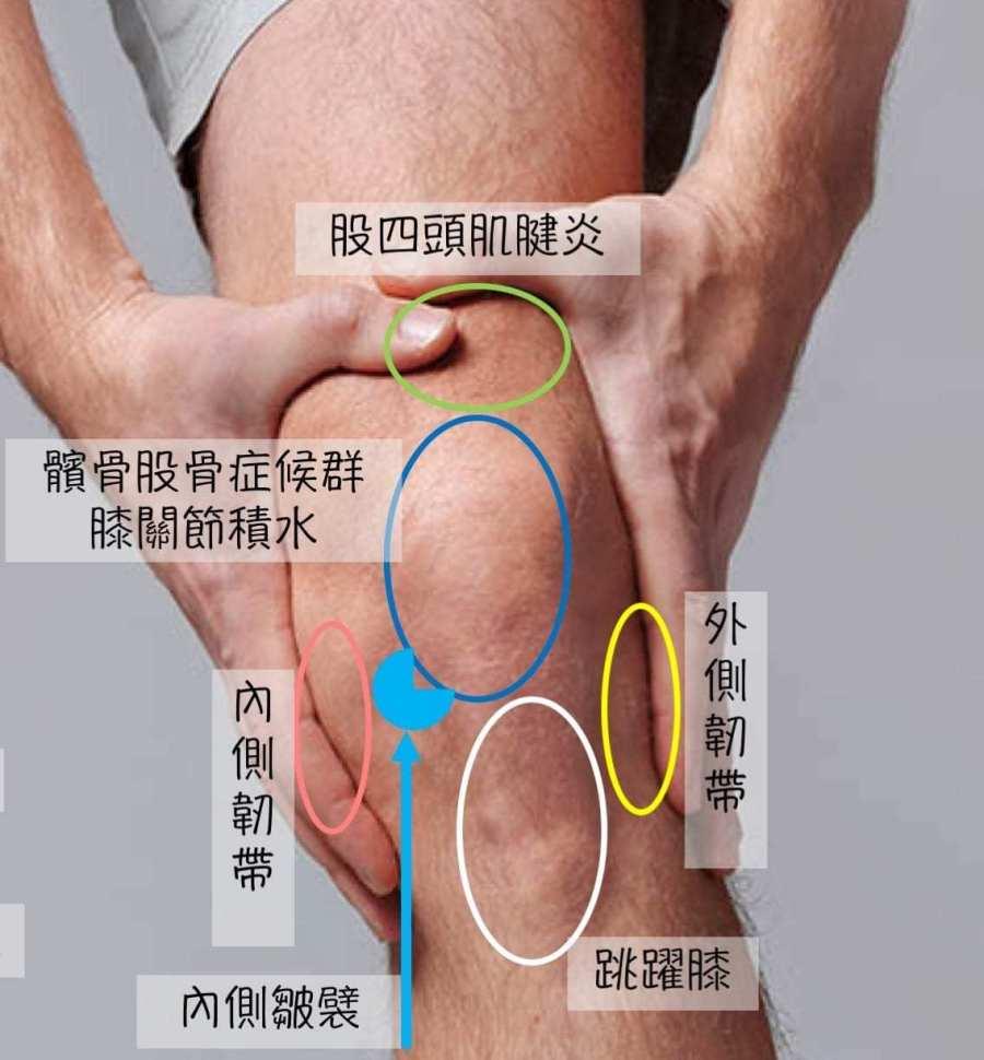 膝关节疼痛自诊部位图图片