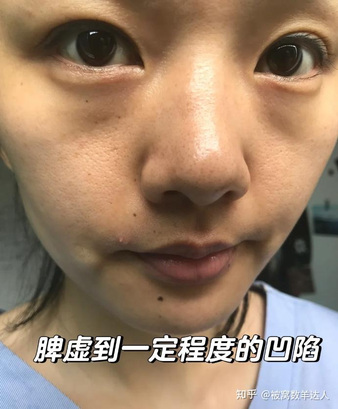 女生身体虚弱,如何预防气血不足啊?