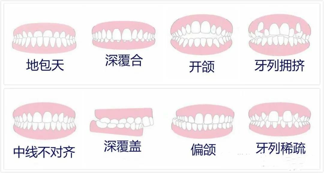 侧颜杀的秘诀居然是下巴形态