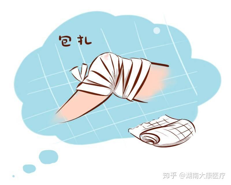 日常生活常见小伤口处理 - 知乎