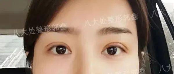 v2-809b28537d50aef26ca54153d32db0a0_1440w.jpg?source=172ae18b