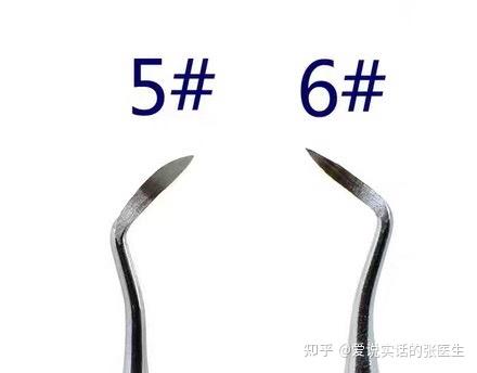 牙周篇-龈上洁治术 - 知乎