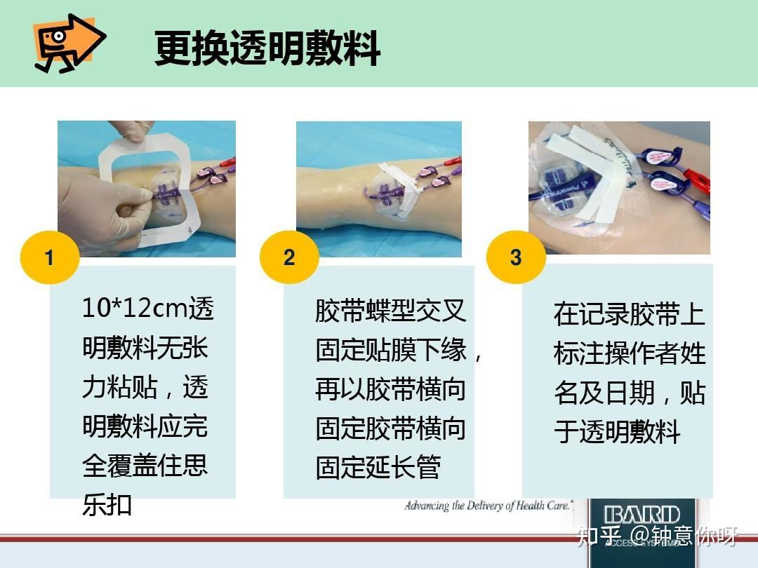 医学科普:敷料换药护理应该怎样办? - 知乎