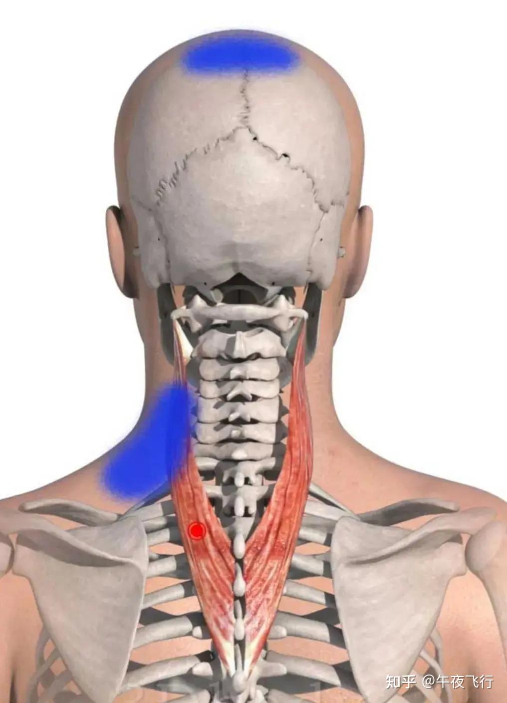 颈椎病通常和这十块肌肉有关(干货分享)