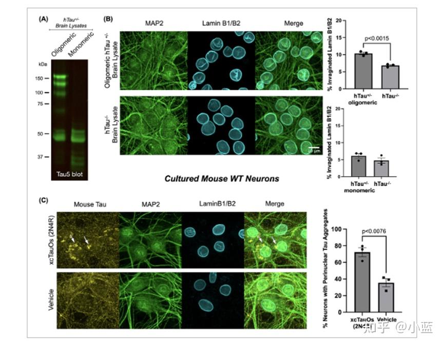 Tau441蛋白在阿尔茨海默症（AD）中应用 - 知乎