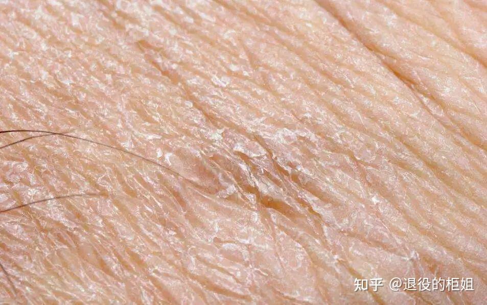 油敏肌该如何护肤？ - 知乎