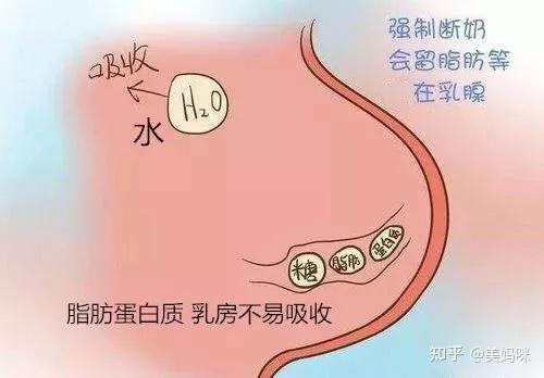 断奶后一定要排出残留乳 千万别拿自己的乳房做赌注 知乎