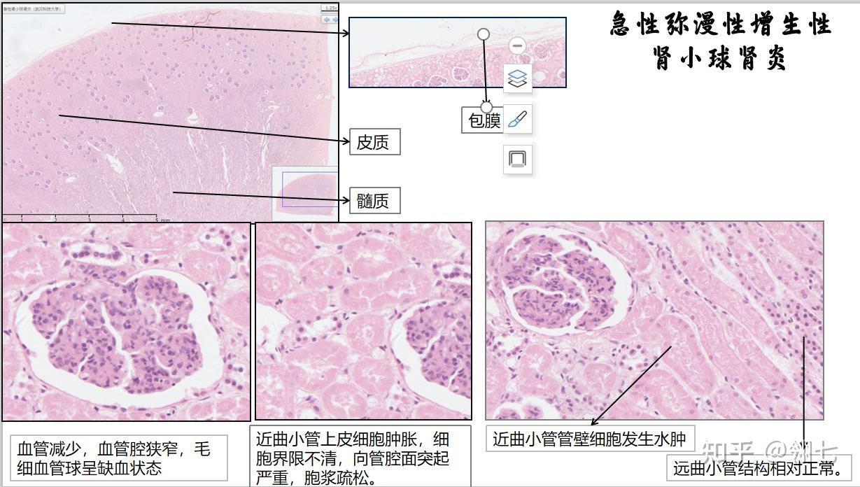 肾组织切片显微镜讲解图片