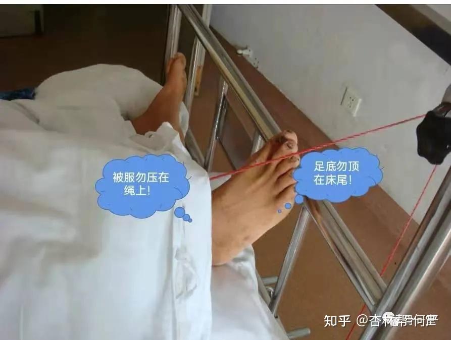 骨牵引健康宣教