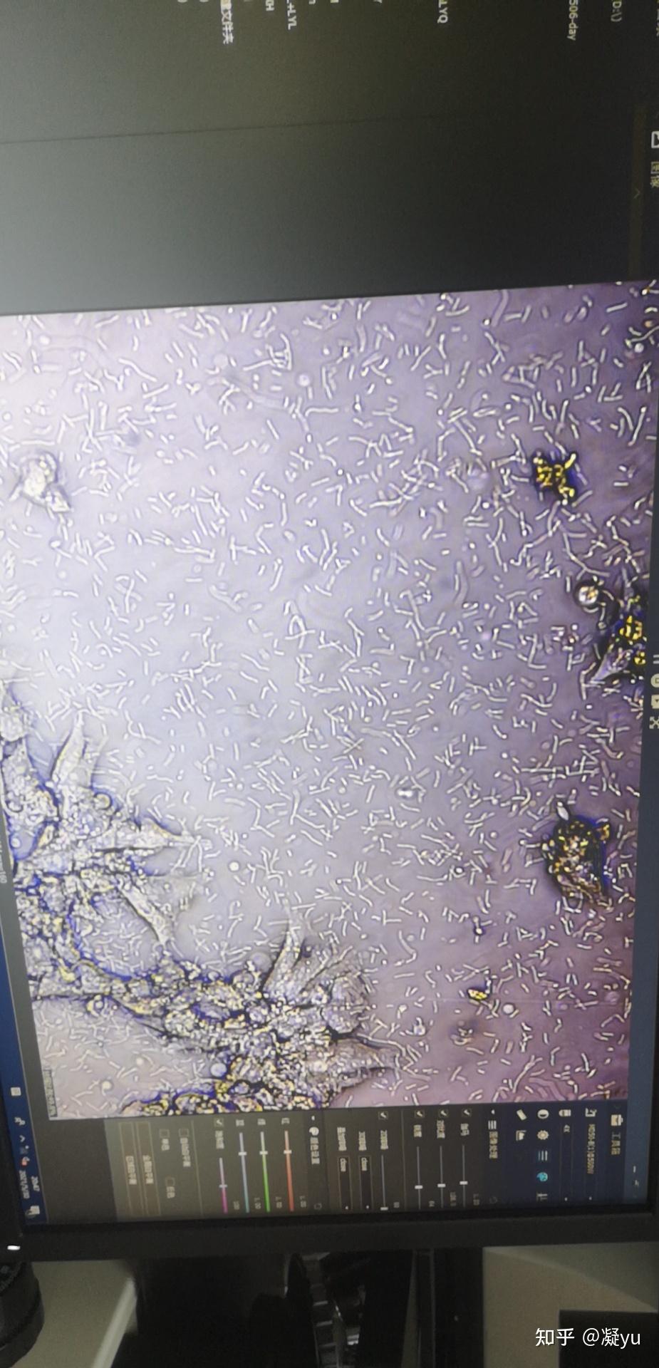 细胞培养真菌感染图片图片