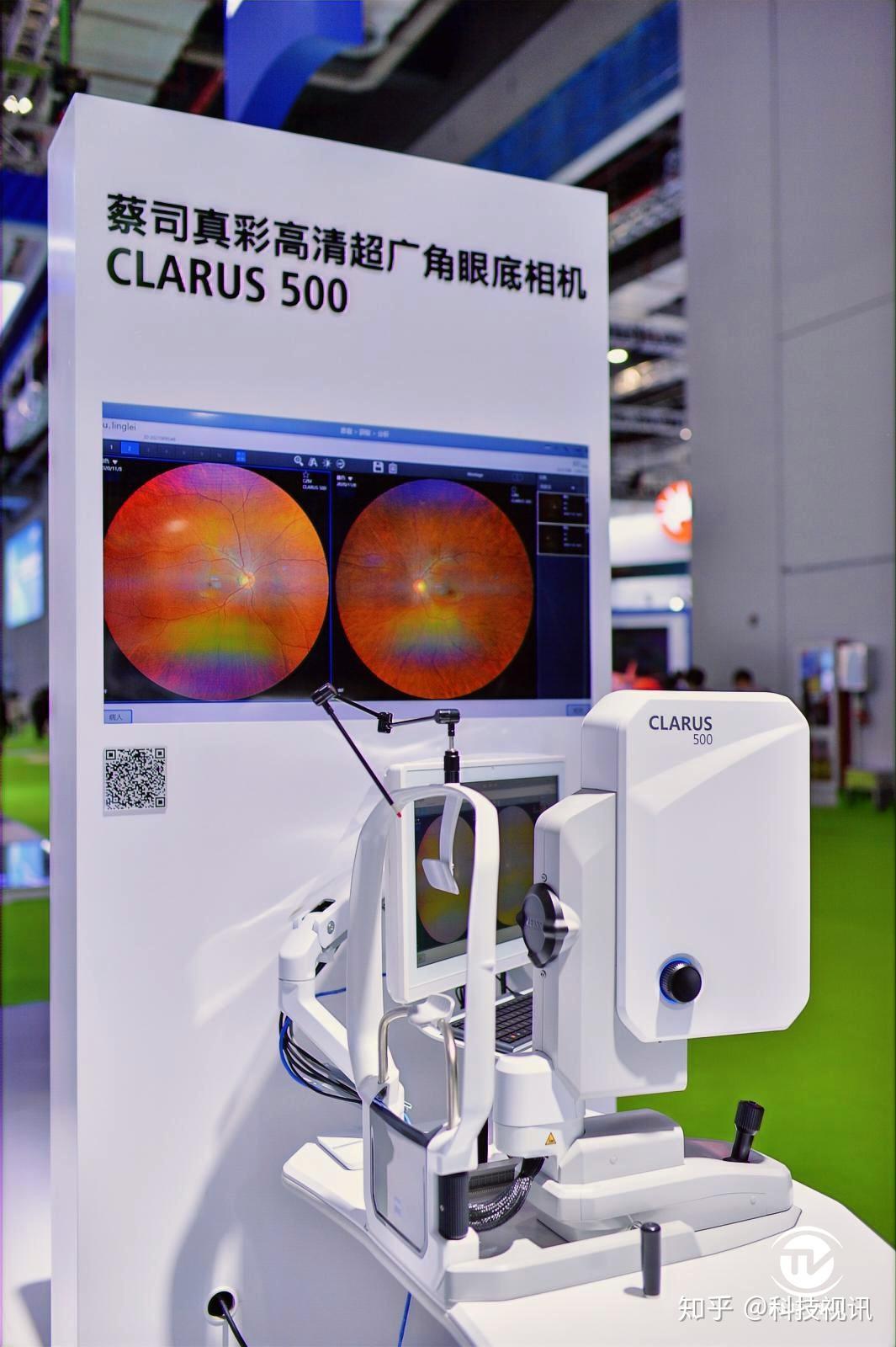 除此之外,蔡司还带来了真彩高清超广角眼底相机clarus 500,60秒就能