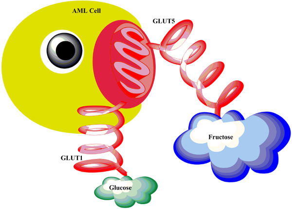 急性髓细胞白血病(acute myeloid leukemia, aml)是一类造血前体细胞