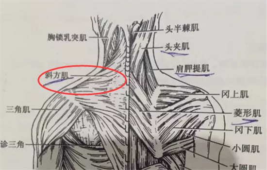 瘦肩针注射位置图 瘦肩针一定要打在这个位置