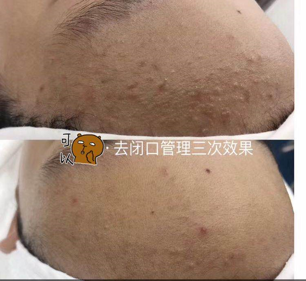 教时常被闭口烦恼的你怎么轻松战胜它? - 知乎