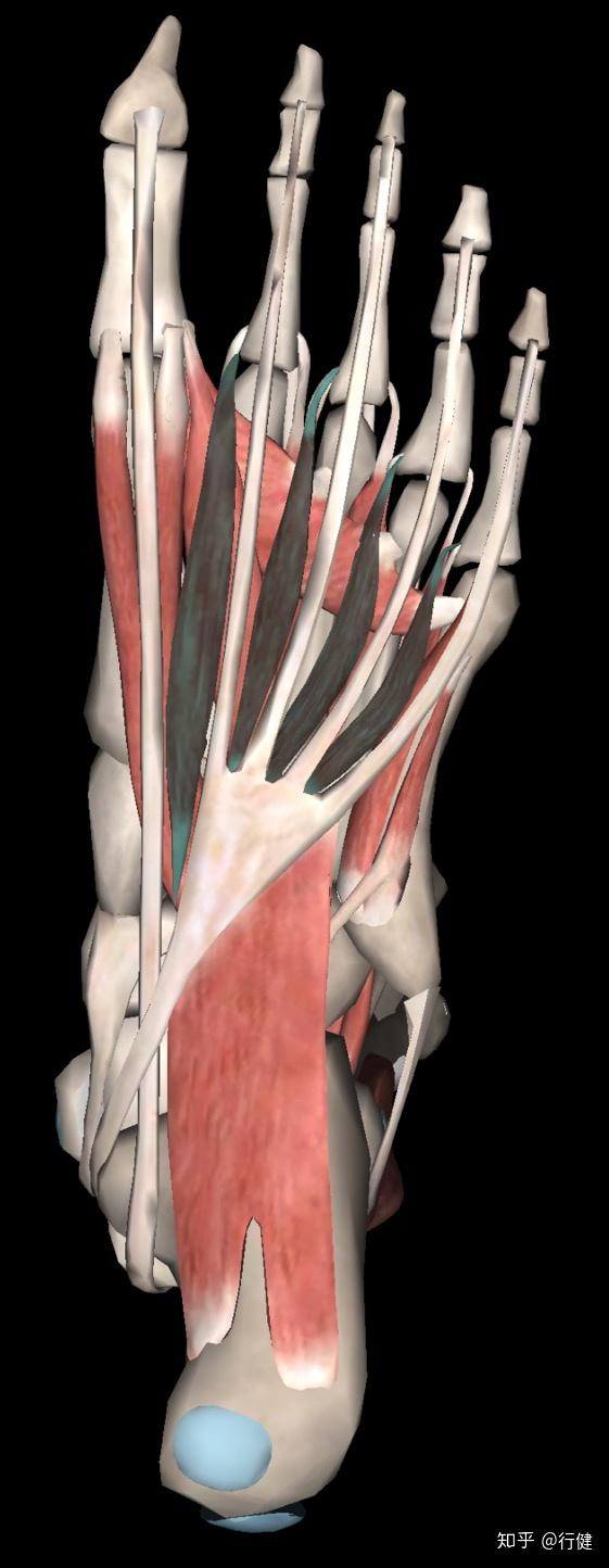 跖痛症跖神经说这锅我不背