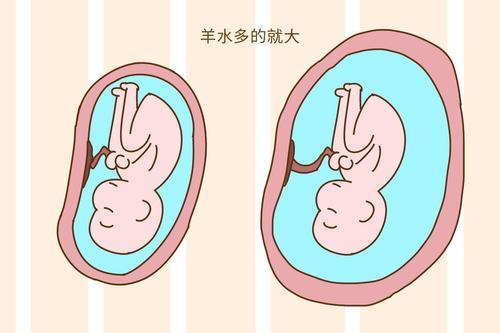 胎盘图片 子宫羊水图片