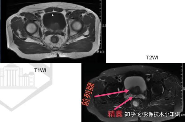 男性生殖系统解剖 - 知乎