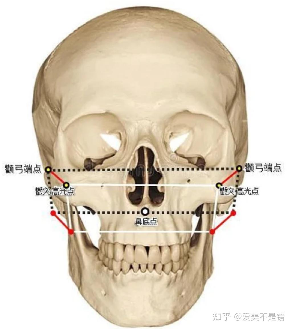 何晋龙解读:简单易懂的判断颧骨高还是颧弓宽的方法? - 知乎
