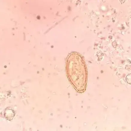 显微镜下的猫屎,竟然和这么多食物都撞脸!