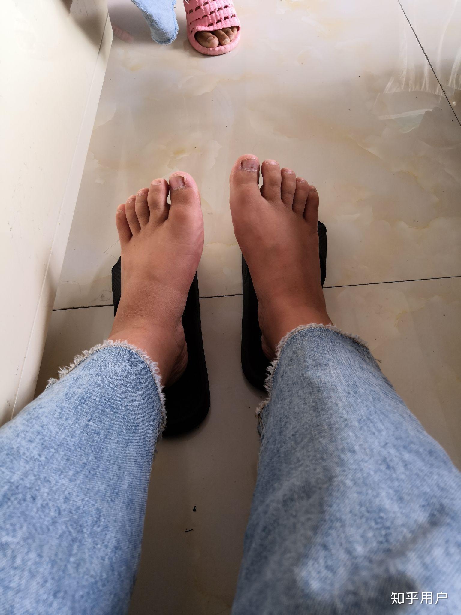 女生脚丑是种什么样的体验