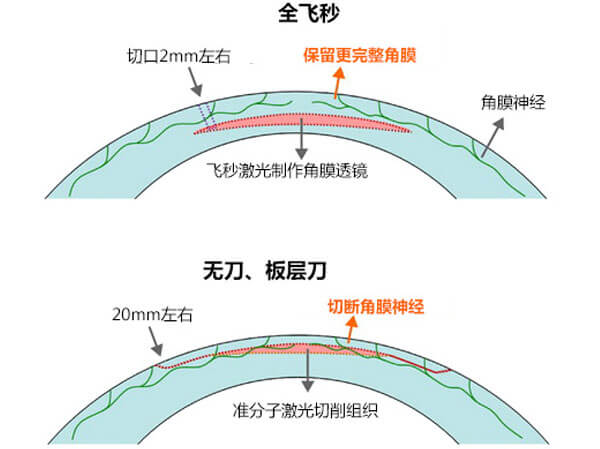 什么是飞秒和半飞秒 v2-825d2a7d6fd719a40b70c5a59f73c3f8_1440w.jpg?source=172ae18b