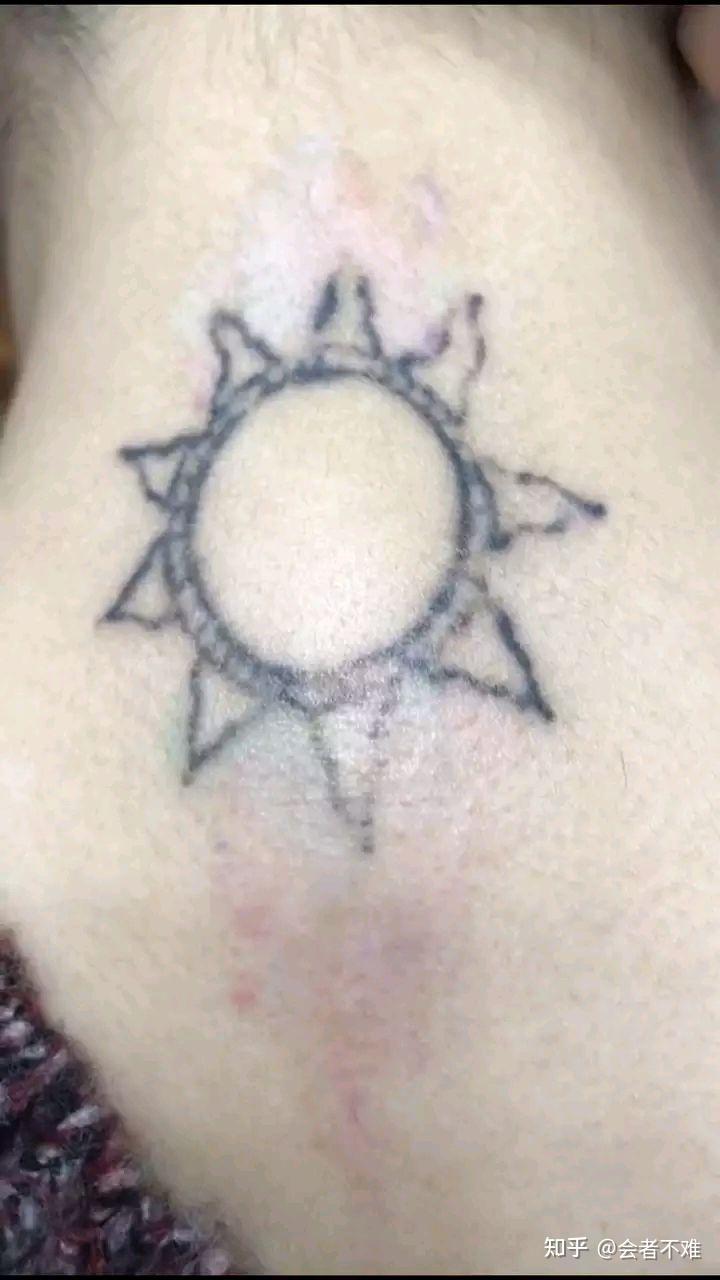梳理一些洗纹身中常见问题