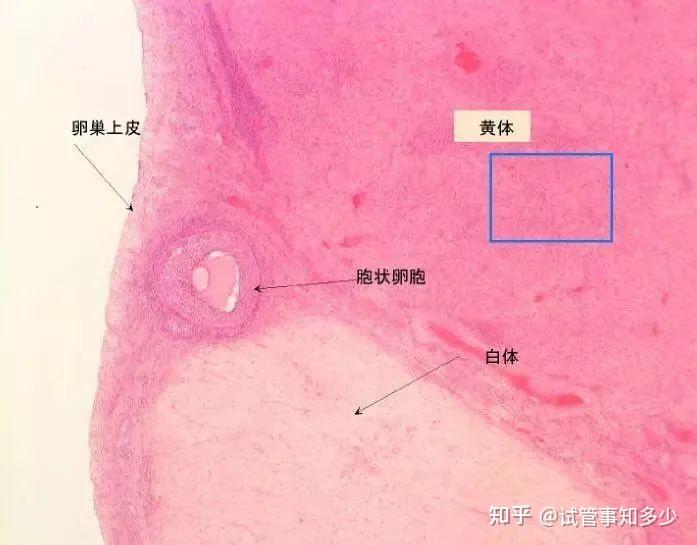 移植后为什么要经常注射黄体？ - 知乎