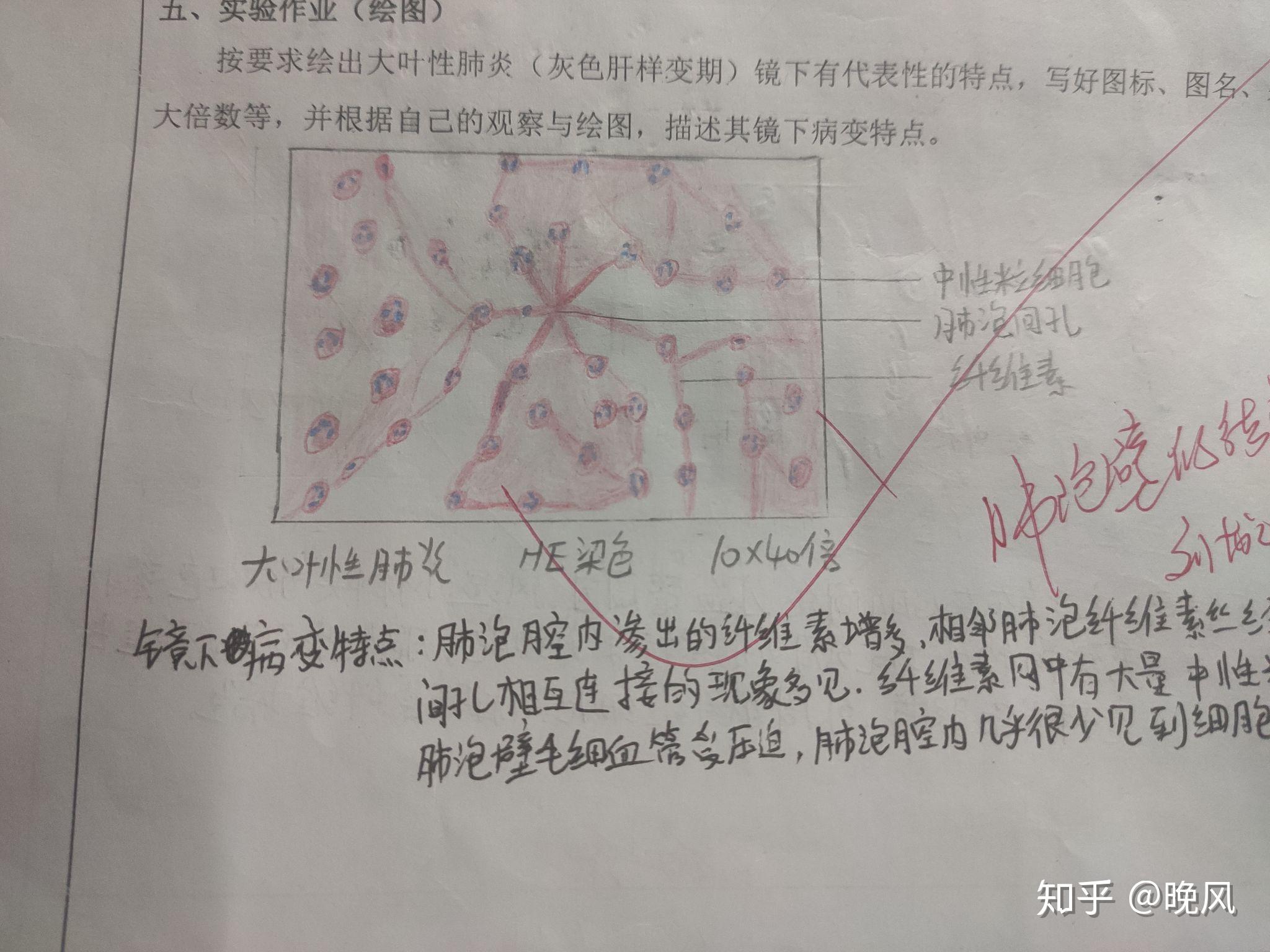 病理学红蓝绘图