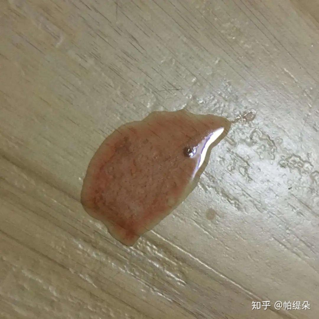 呕吐物带有排泄物这是呕吐中比较严重的情况,猫咪可能患有肠梗阻