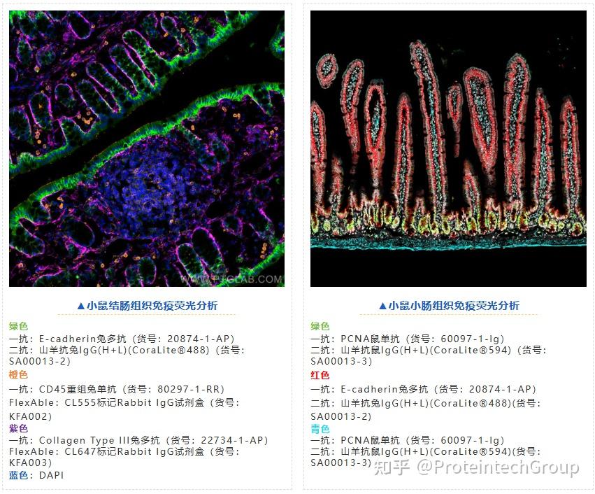 干货 | 多重免疫荧光染色常用方法全解析！附避坑指南 - 知乎